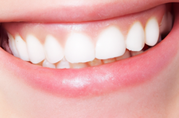 Achieve a Brighter Smile with Our Professional LED Teeth Whitening System