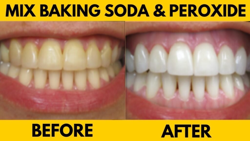 Are There Any Alternatives To Hydrogen Peroxide For Whitening?