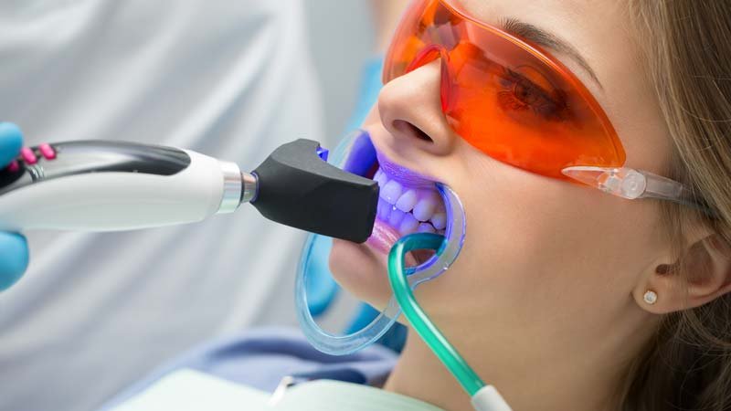 Can Children And Teenagers Undergo Teeth Whitening?