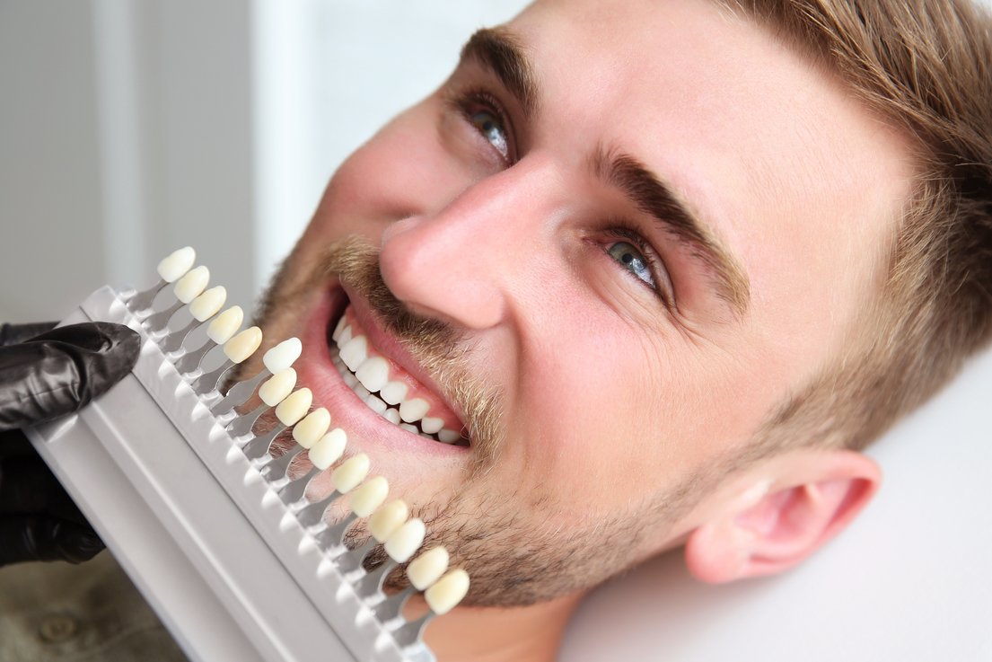 Can I Get My Teeth Whitened If I Have Gum Disease?