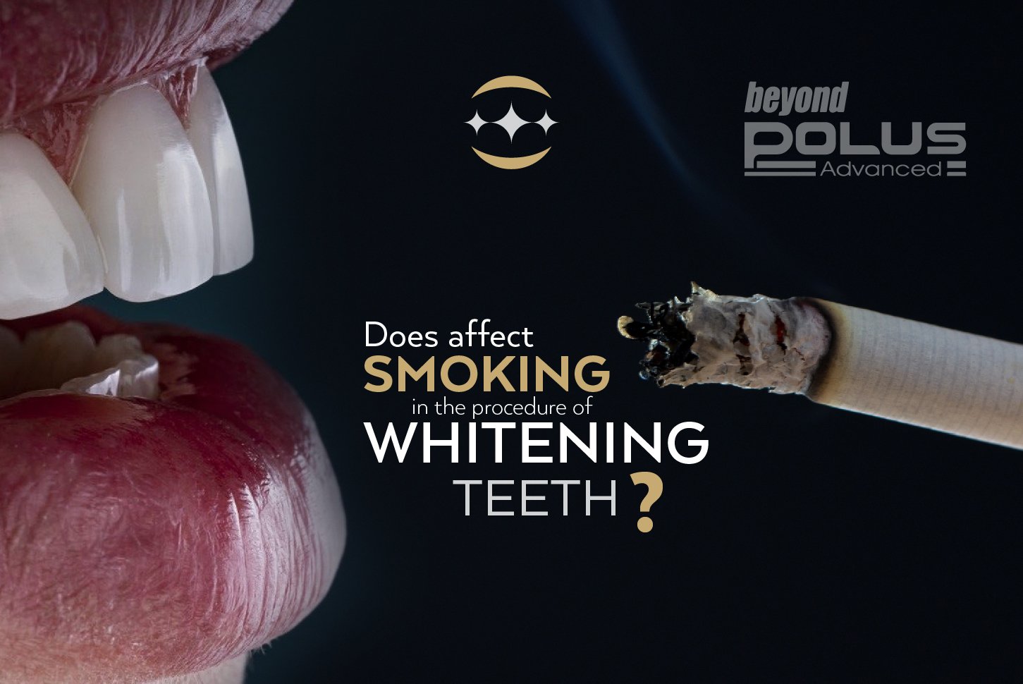 How Does Smoking Impact The Effectiveness Of Teeth Whitening?