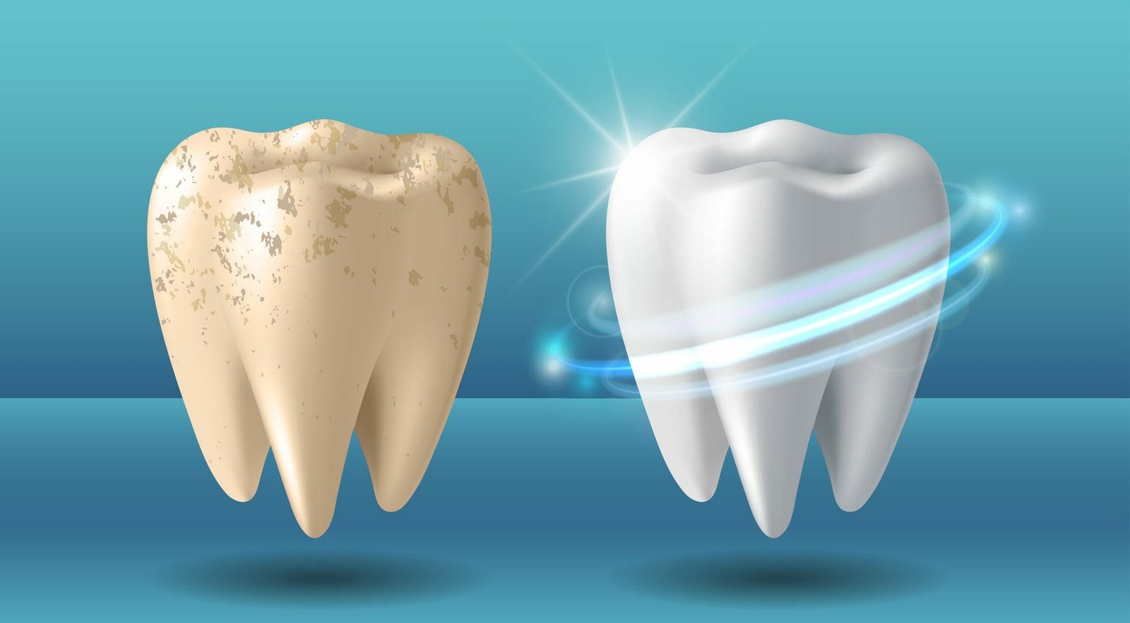 How Does The Natural Color Of Teeth Affect Whitening Outcomes?