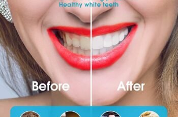 Koouood Tooth Whitening Instrument Review