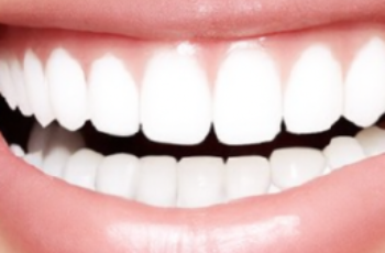 The Duration of Professional Teeth Whitening