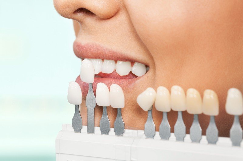 Whats The Role Of Hydrogen Peroxide In Teeth Whitening?